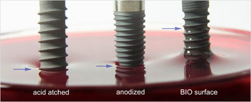 Comparación de superficies de implantes dentales